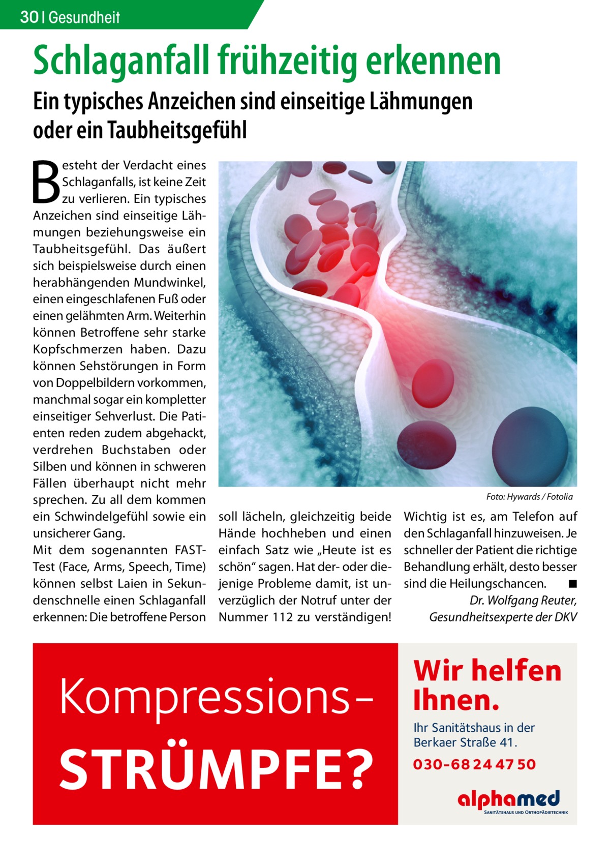 30 Gesundheit  Schlaganfall frühzeitig erkennen Ein typisches Anzeichen sind einseitige Lähmungen oder ein Taubheitsgefühl  B  esteht der Verdacht eines Schlaganfalls, ist keine Zeit zu verlieren. Ein typisches Anzeichen sind einseitige Lähmungen beziehungsweise ein Taubheitsgefühl. Das äußert sich beispielsweise durch einen herabhängenden Mundwinkel, einen eingeschlafenen Fuß oder einen gelähmten Arm. Weiterhin können Betroffene sehr starke Kopfschmerzen haben. Dazu können Sehstörungen in Form von Doppelbildern vorkommen, manchmal sogar ein kompletter einseitiger Sehverlust. Die Patienten reden zudem abgehackt, verdrehen Buchstaben oder Silben und können in schweren Fällen überhaupt nicht mehr sprechen. Zu all dem kommen ein Schwindelgefühl sowie ein unsicherer Gang. Mit dem sogenannten FASTTest (Face, Arms, Speech, Time) können selbst Laien in Sekundenschnelle einen Schlaganfall erkennen: Die betroffene Person  �  soll lächeln, gleichzeitig beide Hände hochheben und einen einfach Satz wie „Heute ist es schön“ sagen. Hat der- oder diejenige Probleme damit, ist unverzüglich der Notruf unter der Nummer 112 zu verständigen!  Kompressions STRÜMPFE?  Foto: Hywards / Fotolia  Wichtig ist es, am Telefon auf den Schlaganfall hinzuweisen. Je schneller der Patient die richtige Behandlung erhält, desto besser sind die Heilungschancen.� ◾ Dr. Wolfgang Reuter, Gesundheitsexperte der DKV  Wir helfen Ihnen. Ihr Sanitätshaus in der Berkaer Straße 41.  030-68 24 47 50