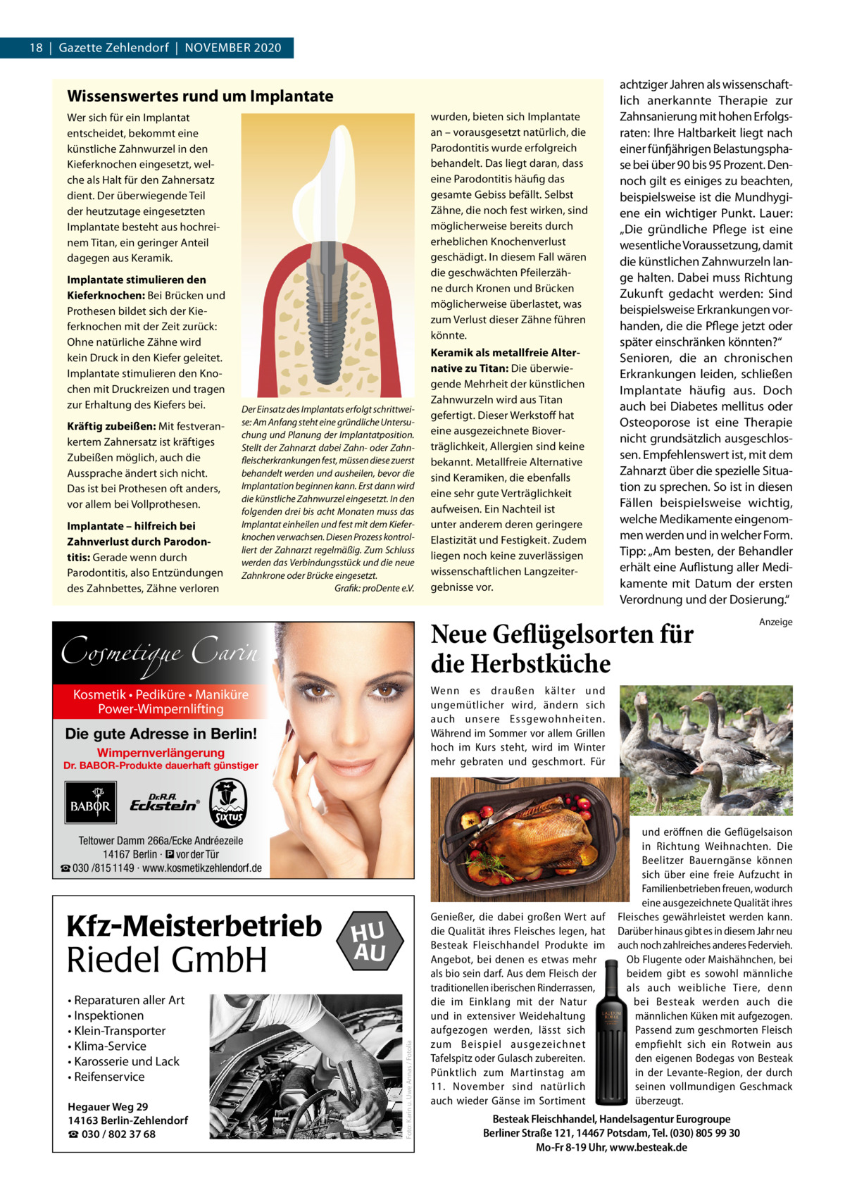 18  |  Gazette Zehlendorf  |  November 2020  Wissenswertes rund um Implantate wurden, bieten sich Implantate an – vorausgesetzt natürlich, die Parodontitis wurde erfolgreich behandelt. Das liegt daran, dass eine Parodontitis häufig das gesamte Gebiss befällt. Selbst Zähne, die noch fest wirken, sind möglicherweise bereits durch erheblichen Knochenverlust geschädigt. In diesem Fall wären die geschwächten Pfeilerzähne durch Kronen und Brücken möglicherweise überlastet, was zum Verlust dieser Zähne führen könnte.  Wer sich für ein Implantat entscheidet, bekommt eine künstliche Zahnwurzel in den Kieferknochen eingesetzt, welche als Halt für den Zahnersatz dient. Der überwiegende Teil der heutzutage eingesetzten Implantate besteht aus hochreinem Titan, ein geringer Anteil dagegen aus Keramik. Implantate stimulieren den Kieferknochen: Bei Brücken und Prothesen bildet sich der Kieferknochen mit der Zeit zurück: Ohne natürliche Zähne wird kein Druck in den Kiefer geleitet. Implantate stimulieren den Knochen mit Druckreizen und tragen zur Erhaltung des Kiefers bei. Kräftig zubeißen: Mit festverankertem Zahnersatz ist kräftiges Zubeißen möglich, auch die Aussprache ändert sich nicht. Das ist bei Prothesen oft anders, vor allem bei Vollprothesen. Implantate – hilfreich bei Zahnverlust durch Parodontitis: Gerade wenn durch Parodontitis, also Entzündungen des Zahnbettes, Zähne verloren  Der Einsatz des Implantats erfolgt schrittweise: Am Anfang steht eine gründliche Untersuchung und Planung der Implantatposition. Stellt der Zahnarzt dabei Zahn- oder Zahnfleischerkrankungen fest, müssen diese zuerst behandelt werden und ausheilen, bevor die Implantation beginnen kann. Erst dann wird die künstliche Zahnwurzel eingesetzt. In den folgenden drei bis acht Monaten muss das Implantat einheilen und fest mit dem Kieferknochen verwachsen. Diesen Prozess kontrolliert der Zahnarzt regelmäßig. Zum Schluss werden das Verbindungsstück und die neue Zahnkrone oder Brücke eingesetzt. � Grafik: proDente e.V.  Keramik als metallfreie Alternative zu Titan: Die überwiegende Mehrheit der künstlichen Zahnwurzeln wird aus Titan gefertigt. Dieser Werkstoff hat eine ausgezeichnete Bioverträglichkeit, Allergien sind keine bekannt. Metallfreie Alternative sind Keramiken, die ebenfalls eine sehr gute Verträglichkeit aufweisen. Ein Nachteil ist unter anderem deren geringere Elastizität und Festigkeit. Zudem liegen noch keine zuverlässigen wissenschaftlichen Langzeitergebnisse vor.  Neue Geflügelsorten für die Herbstküche  Cosmetique Carin Die gute Adresse in Berlin! Wimpernverlängerung  Dr. BABOR-Produkte dauerhaft günstiger  Teltower Damm 266a/Ecke Andréezeile 14167 Berlin · � vor der Tür ☎ 030 /815 1149 · www.kosmetikzehlendorf.de  • Reparaturen aller Art • Inspektionen • Klein-Transporter • Klima-Service • Karosserie und Lack • Reifenservice Hegauer Weg 29 14163 Berlin-Zehlendorf ☎ 030 / 802 37 68  HU AU  Foto: Karin u. Uwe Annas / Fotolia  Riedel GmbH  Anzeige  Wenn es draußen k älter und ungemütlicher wird, ändern sich auch unsere Essgewohnheiten. Während im Sommer vor allem Grillen hoch im Kurs steht, wird im Winter mehr gebraten und geschmort. Für  Kosmetik • Pediküre • Maniküre Power-Wimpernlifting  Kfz-Meisterbetrieb  achtziger Jahren als wissenschaftlich anerkannte Therapie zur Zahnsanierung mit hohen Erfolgsraten: Ihre Haltbarkeit liegt nach einer fünfjährigen Belastungsphase bei über 90 bis 95 Prozent. Dennoch gilt es einiges zu beachten, beispielsweise ist die Mundhygiene ein wichtiger Punkt. Lauer: „Die gründliche Pflege ist eine wesentliche Voraussetzung, damit die künstlichen Zahnwurzeln lange halten. Dabei muss Richtung Zukunft gedacht werden: Sind beispielsweise Erkrankungen vorhanden, die die Pflege jetzt oder später einschränken könnten?“ Senioren, die an chronischen Erkrankungen leiden, schließen Implantate häufig aus. Doch auch bei Diabetes mellitus oder Osteoporose ist eine Therapie nicht grundsätzlich ausgeschlossen. Empfehlenswert ist, mit dem Zahnarzt über die spezielle Situation zu sprechen. So ist in diesen Fällen beispielsweise wichtig, welche Medikamente eingenommen werden und in welcher Form. Tipp: „Am besten, der Behandler erhält eine Auflistung aller Medikamente mit Datum der ersten Verordnung und der Dosierung.“  Genießer, die dabei großen Wert auf die Qualität ihres Fleisches legen, hat Besteak Fleischhandel Produkte im Angebot, bei denen es etwas mehr als bio sein darf. Aus dem Fleisch der traditionellen iberischen Rinderrassen, die im Einklang mit der Natur und in extensiver Weidehaltung aufgezogen werden, lässt sich zum Beispiel ausgezeichnet Tafelspitz oder Gulasch zubereiten. Pünktlich zum Martinstag am 11.  November sind natürlich auch wieder Gänse im Sortiment  und eröffnen die Geflügelsaison in Richtung Weihnachten. Die Beelitzer Bauerngänse können sich über eine freie Aufzucht in Familienbetrieben freuen, wodurch eine ausgezeichnete Qualität ihres Fleisches gewährleistet werden kann. Darüber hinaus gibt es in diesem Jahr neu auch noch zahlreiches anderes Federvieh. Ob Flugente oder Maishähnchen, bei beidem gibt es sowohl männliche als auch weibliche Tiere, denn bei Besteak werden auch die männlichen Küken mit aufgezogen. Passend zum geschmorten Fleisch empfiehlt sich ein Rotwein aus den eigenen Bodegas von Besteak in der Levante-Region, der durch seinen vollmundigen Geschmack überzeugt.  Besteak Fleischhandel, Handelsagentur Eurogroupe Berliner Straße 121, 14467 Potsdam, Tel. (030) 805 99 30 Mo-Fr 8-19 Uhr, www.besteak.de