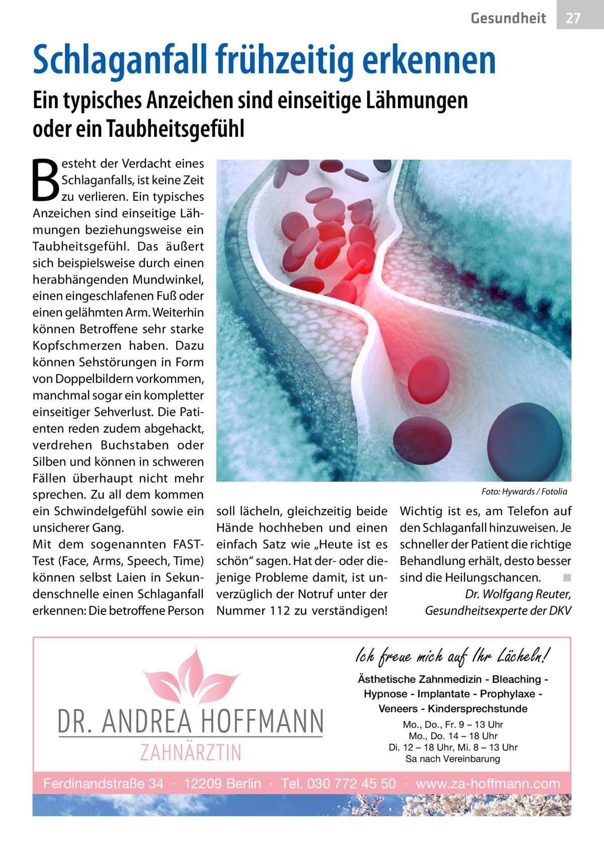 Gesundheit  27 27  Schlaganfall frühzeitig erkennen Ein typisches Anzeichen sind einseitige Lähmungen oder ein Taubheitsgefühl  B  esteht der Verdacht eines Schlaganfalls, ist keine Zeit zu verlieren. Ein typisches Anzeichen sind einseitige Lähmungen beziehungsweise ein Taubheitsgefühl. Das äußert sich beispielsweise durch einen herabhängenden Mundwinkel, einen eingeschlafenen Fuß oder einen gelähmten Arm. Weiterhin können Betroffene sehr starke Kopfschmerzen haben. Dazu können Sehstörungen in Form von Doppelbildern vorkommen, manchmal sogar ein kompletter einseitiger Sehverlust. Die Patienten reden zudem abgehackt, verdrehen Buchstaben oder Silben und können in schweren Fällen überhaupt nicht mehr sprechen. Zu all dem kommen ein Schwindelgefühl sowie ein unsicherer Gang. Mit dem sogenannten FASTTest (Face, Arms, Speech, Time) können selbst Laien in Sekundenschnelle einen Schlaganfall erkennen: Die betroffene Person  �  Foto: Hywards / Fotolia  soll lächeln, gleichzeitig beide Hände hochheben und einen einfach Satz wie „Heute ist es schön“ sagen. Hat der- oder diejenige Probleme damit, ist unverzüglich der Notruf unter der Nummer 112 zu verständigen!  Wichtig ist es, am Telefon auf den Schlaganfall hinzuweisen. Je schneller der Patient die richtige Behandlung erhält, desto besser sind die Heilungschancen.� ◾ Dr. Wolfgang Reuter, Gesundheitsexperte der DKV  Ich freue mich auf Ihr Lächeln! Ästhetische Zahnmedizin - Bleaching Hypnose - Implantate - Prophylaxe Veneers - Kindersprechstunde Mo., Do., Fr. 9 – 13 Uhr Mo., Do. 14 – 18 Uhr Di. 12 – 18 Uhr, Mi. 8 – 13 Uhr Sa nach Vereinbarung  Ferdinandstraße 34 · 12209 Berlin · Tel. 030 772 45 50 · www.za-hoffmann.com
