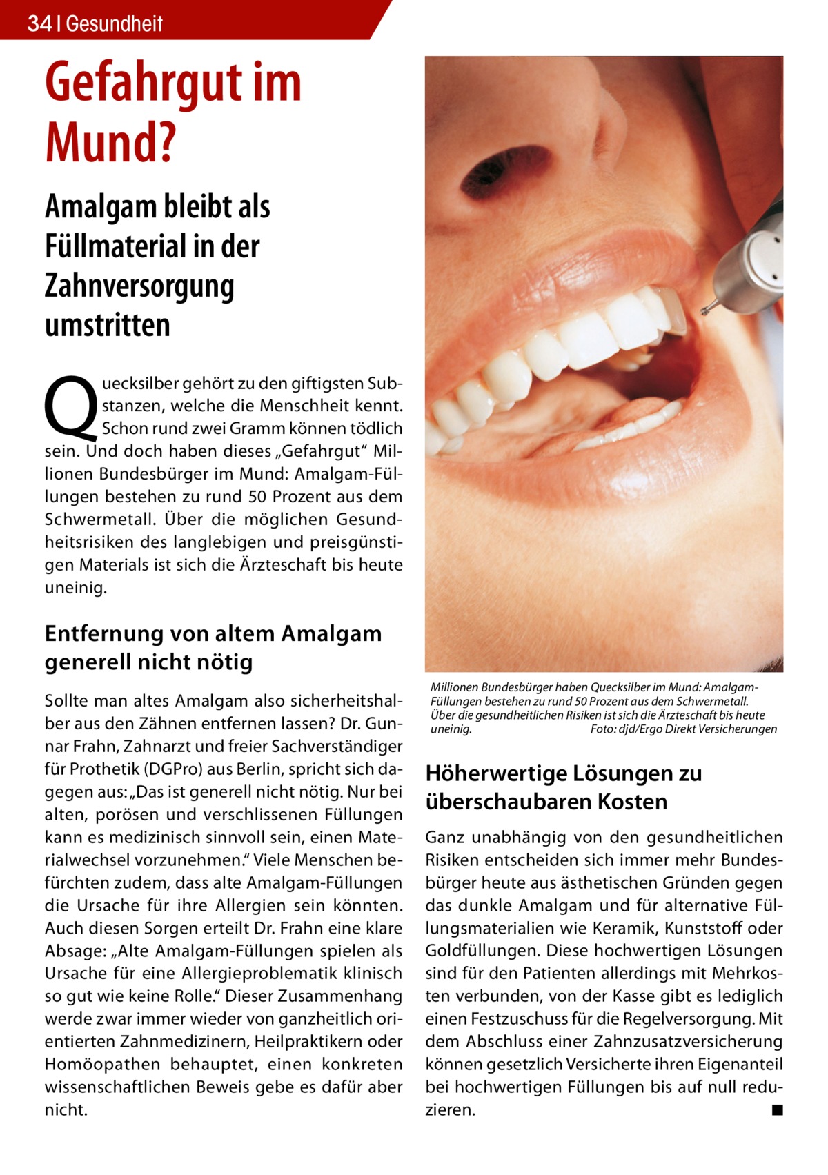 34 Gesundheit  Gefahrgut im Mund? Amalgam bleibt als Füllmaterial in der Zahnversorgung umstritten  Q  uecksilber gehört zu den giftigsten Substanzen, welche die Menschheit kennt. Schon rund zwei Gramm können tödlich sein. Und doch haben dieses „Gefahrgut“ Millionen Bundesbürger im Mund: Amalgam-Füllungen bestehen zu rund 50 Prozent aus dem Schwermetall. Über die möglichen Gesundheitsrisiken des langlebigen und preisgünstigen Materials ist sich die Ärzteschaft bis heute uneinig.  Entfernung von altem Amalgam generell nicht nötig Sollte man altes Amalgam also sicherheitshalber aus den Zähnen entfernen lassen? Dr. Gunnar Frahn, Zahnarzt und freier Sachverständiger für Prothetik (DGPro) aus Berlin, spricht sich dagegen aus: „Das ist generell nicht nötig. Nur bei alten, porösen und verschlissenen Füllungen kann es medizinisch sinnvoll sein, einen Materialwechsel vorzunehmen.“ Viele Menschen befürchten zudem, dass alte Amalgam-Füllungen die Ursache für ihre Allergien sein könnten. Auch diesen Sorgen erteilt Dr. Frahn eine klare Absage: „Alte Amalgam-Füllungen spielen als Ursache für eine Allergieproblematik klinisch so gut wie keine Rolle.“ Dieser Zusammenhang werde zwar immer wieder von ganzheitlich orientierten Zahnmedizinern, Heilpraktikern oder Homöopathen behauptet, einen konkreten wissenschaftlichen Beweis gebe es dafür aber nicht.  Millionen Bundesbürger haben Quecksilber im Mund: AmalgamFüllungen bestehen zu rund 50 Prozent aus dem Schwermetall. Über die gesundheitlichen Risiken ist sich die Ärzteschaft bis heute uneinig.� Foto: djd/Ergo Direkt Versicherungen  Höherwertige Lösungen zu überschaubaren Kosten Ganz unabhängig von den gesundheitlichen Risiken entscheiden sich immer mehr Bundesbürger heute aus ästhetischen Gründen gegen das dunkle Amalgam und für alternative Füllungsmaterialien wie Keramik, Kunststoff oder Goldfüllungen. Diese hochwertigen Lösungen sind für den Patienten allerdings mit Mehrkosten verbunden, von der Kasse gibt es lediglich einen Festzuschuss für die Regelversorgung. Mit dem Abschluss einer Zahnzusatzversicherung können gesetzlich Versicherte ihren Eigenanteil bei hochwertigen Füllungen bis auf null reduzieren. � ◾