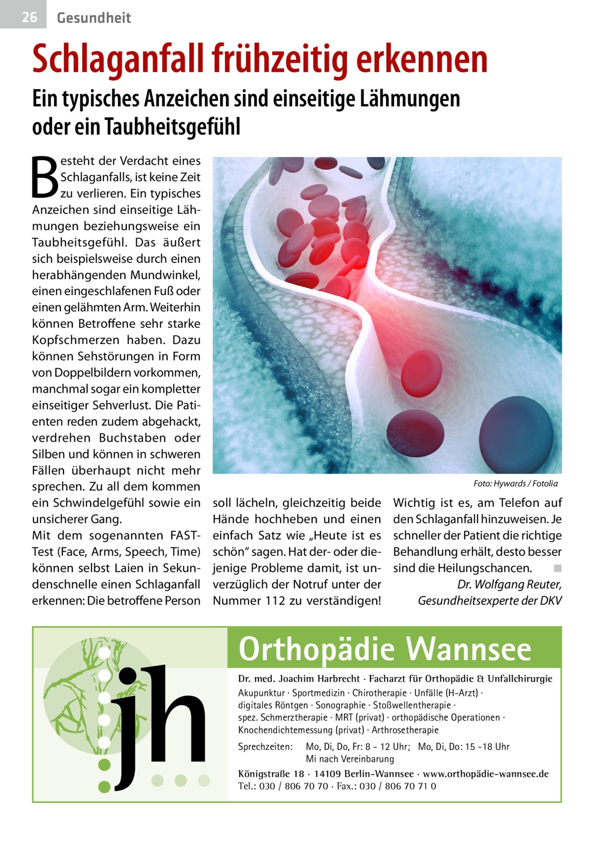 26  Gesundheit  Schlaganfall frühzeitig erkennen Ein typisches Anzeichen sind einseitige Lähmungen oder ein Taubheitsgefühl  B  esteht der Verdacht eines Schlaganfalls, ist keine Zeit zu verlieren. Ein typisches Anzeichen sind einseitige Lähmungen beziehungsweise ein Taubheitsgefühl. Das äußert sich beispielsweise durch einen herabhängenden Mundwinkel, einen eingeschlafenen Fuß oder einen gelähmten Arm. Weiterhin können Betroffene sehr starke Kopfschmerzen haben. Dazu können Sehstörungen in Form von Doppelbildern vorkommen, manchmal sogar ein kompletter einseitiger Sehverlust. Die Patienten reden zudem abgehackt, verdrehen Buchstaben oder Silben und können in schweren Fällen überhaupt nicht mehr sprechen. Zu all dem kommen ein Schwindelgefühl sowie ein unsicherer Gang. Mit dem sogenannten FASTTest (Face, Arms, Speech, Time) können selbst Laien in Sekundenschnelle einen Schlaganfall erkennen: Die betroffene Person  �  Foto: Hywards / Fotolia  soll lächeln, gleichzeitig beide Hände hochheben und einen einfach Satz wie „Heute ist es schön“ sagen. Hat der- oder diejenige Probleme damit, ist unverzüglich der Notruf unter der Nummer 112 zu verständigen!  Wichtig ist es, am Telefon auf den Schlaganfall hinzuweisen. Je schneller der Patient die richtige Behandlung erhält, desto besser sind die Heilungschancen.� ◾ Dr. Wolfgang Reuter, Gesundheitsexperte der DKV  Orthopädie Wannsee Dr. med. Joachim Harbrecht · Facharzt für Orthopädie & Unfallchirurgie Akupunktur · Sportmedizin · Chirotherapie · Unfälle (H-Arzt) · digitales Röntgen · Sonographie · Stoßwellentherapie · spez. Schmerztherapie · MRT (privat) · orthopädische Operationen · Knochendichtemessung (privat) · Arthrosetherapie Sprechzeiten:  Mo, Di, Do, Fr: 8 - 12 Uhr; Mo, Di, Do: 15 -18 Uhr Mi nach Vereinbarung Königstraße 18 · 14109 Berlin-Wannsee · www.orthopädie-wannsee.de Tel.: 030 / 806 70 70 · Fax.: 030 / 806 70 71 0